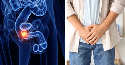 Eturauhanen. Kuvat: Shutterstock