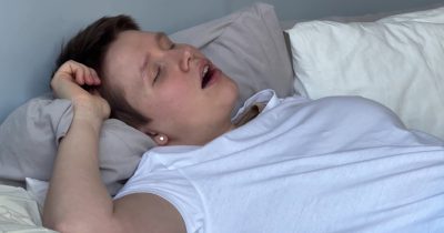 Suun kuivumisen takana voi olla monia erilaisia tekijöitä. Tässä on listattuna 8 yleisintä syytä.