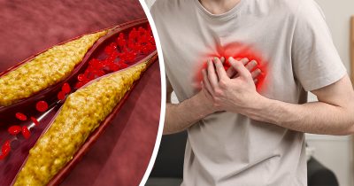 tukkoinen verisuoni. Mies pitelemässä rintakehäänsä. Kuvat: Shutterstock