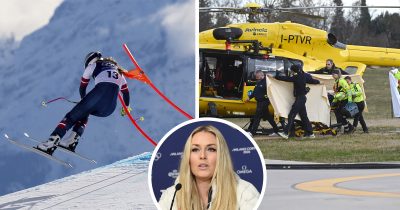 Lindsey Vonn loukkaantui vakavasti syöksylaskukisassa ja julkaisi nyt kuvan sairaalasta leikkausten jälkeen.