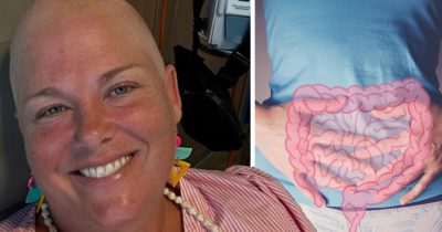 Suolistosyöpään sairastunut Susan Schmidt kertoo nyt oireet, jotka sivuutti liian pitkään ennen diagnoosia.