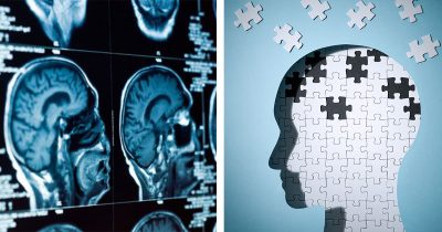 Dementia ei ole pelkkiä muistiin liittyviä oireita.