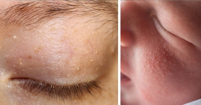 Miliat eivät ole vaarallisia