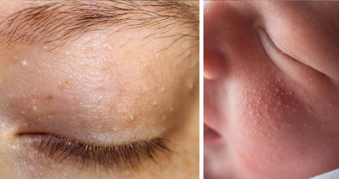 Miliat eivät ole vaarallisia