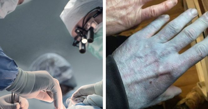 Kirurgi ja sininen käsi