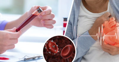 Tutkimuksen mukaan tietyllä veriryhmällä on alhaisempi riskiä kärsiä sydänkohtauksesta tai veritulpista.