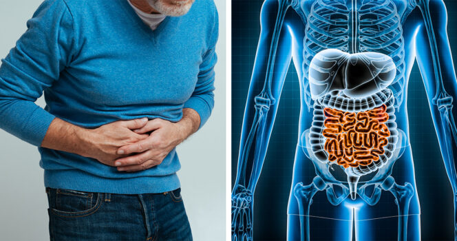 IBD. Kuvat Shutterstock