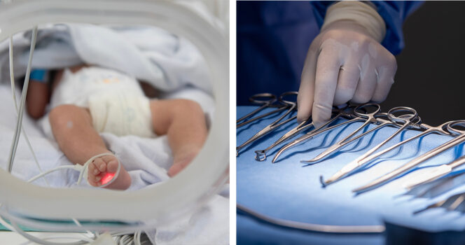 Vauva, kirurgiset välineet. Kuvat: Shutterstock
