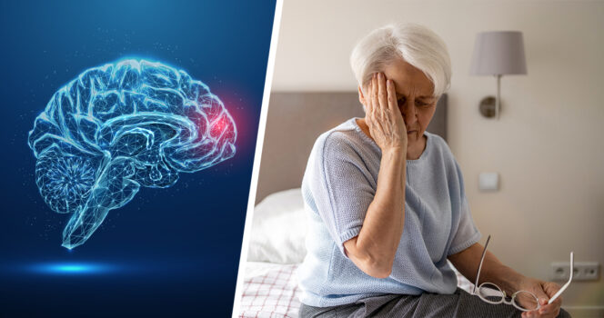 Dementia. Kuvat Shutterstock
