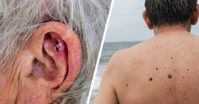 Ihosyöpä. Kuvat: Shutterstock