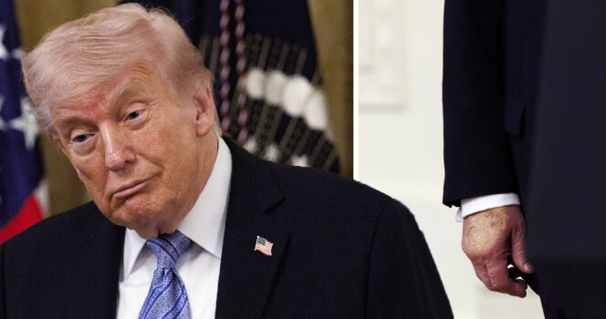 Donald Trump myöntää käyttävänsä lääkettä vastoin lääkärin ohjeistusta.