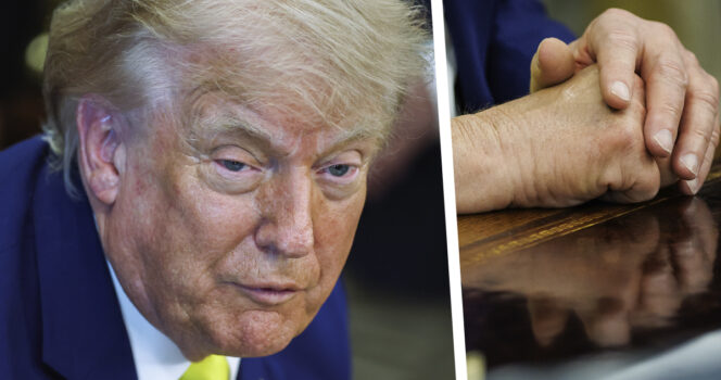 Donald Trumpin paluu viikon katoamisen jälkeen on herättänyt huolta terveydestä.