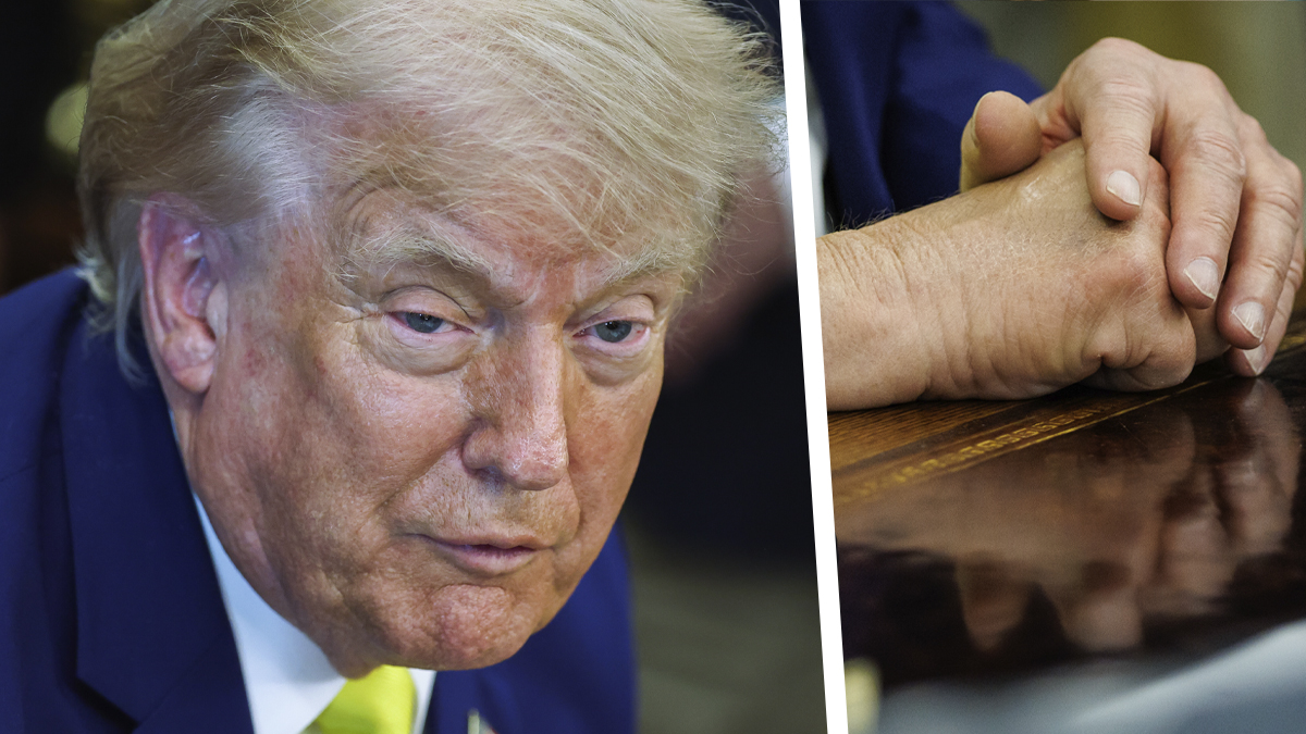 Donald Trumpin paluu viikon katoamisen jälkeen on herättänyt huolta terveydestä.