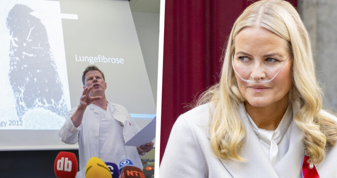 Asiantuntija kertoo nyt, miten Mette-Marit sai uudet keuhkot näin nopeasti.