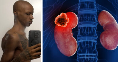 Nickodemus Dacres. Munuaissyöpä. Kuvat: Go Fund Me, Shutterstock