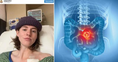 Paige Seifert (24) fikk kreft – symptomene hun advarer mot