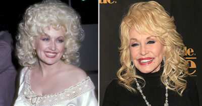 Dolly Parton (80) er død