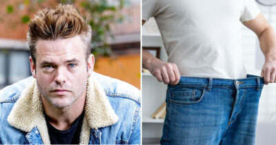 Silas Holst får på puklen efter vægttab.