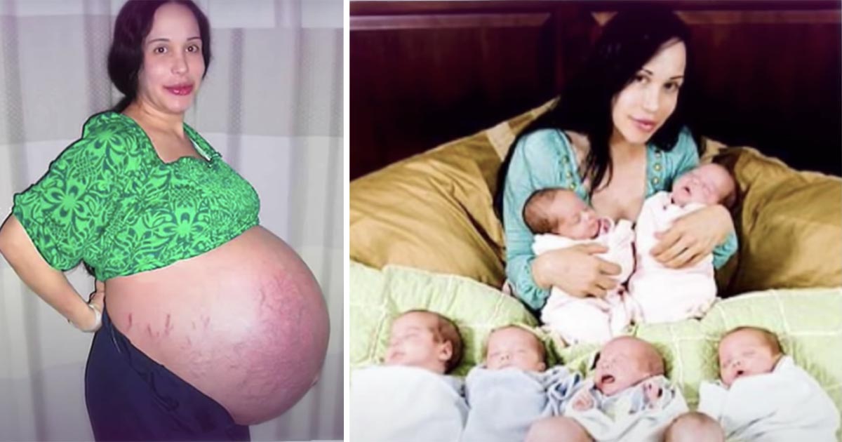 Natalie “Octomom” Suleman
