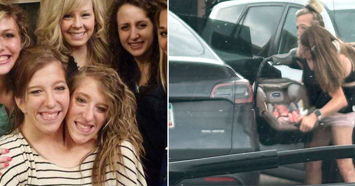 De siamesiske tvillinger Abigail og Britanny er ved flere lejligheder blev set med en baby.