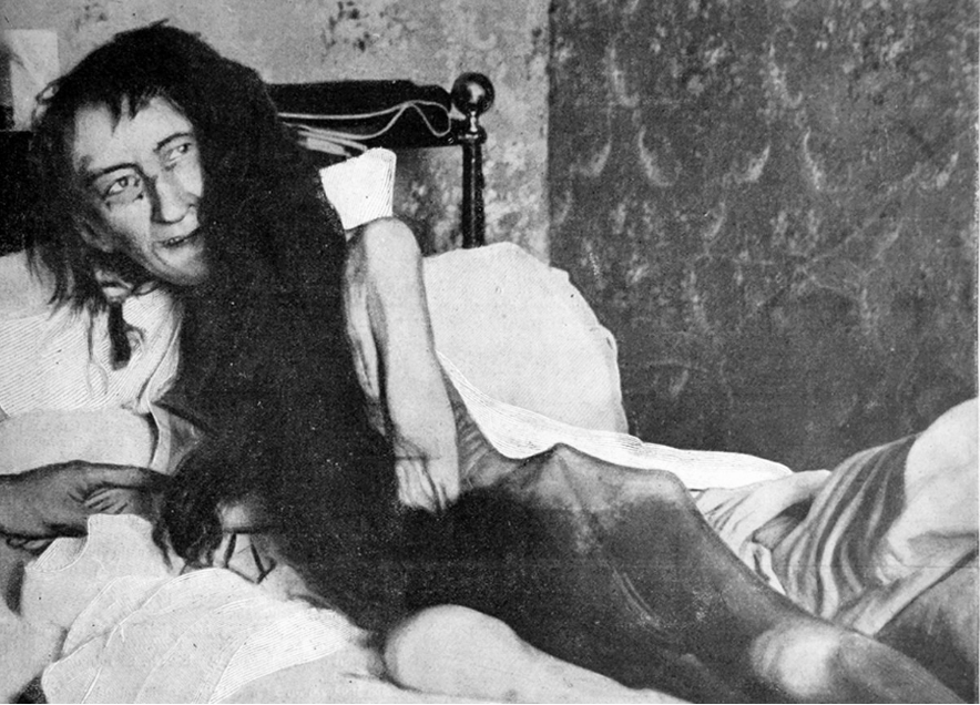 Blanche Monnier var indespærret på et loft i årevis.
