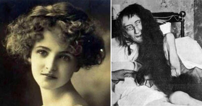 Blanche Monnier blev fundet på et loftsværelse, hvor hun havde været indespærret i mange år.