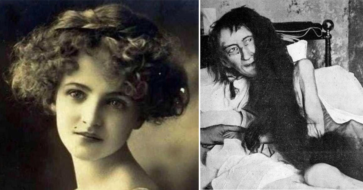 Blanche Monnier blev fundet på et loftsværelse, hvor hun havde været indespærret i mange år.