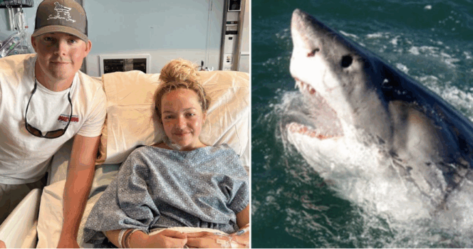 Addison Bethea blev angrebet af en haj og mistede benet.