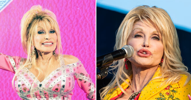 Sangerinden Dolly Parton maner nu til besindighed.