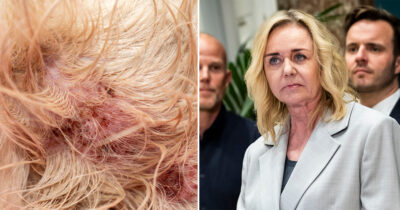 Mona Juuls hund er kommet slemt til skade efter overfald.