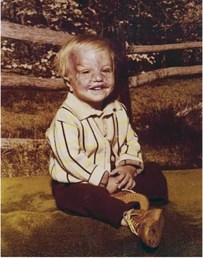 Keith Edmonds fik en svær start på livet.