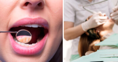 Danskerne ønsker gratis tandlæge