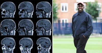 Melvin Kakooza har skruet ned for tempoet, efter han blev ramt af en hjernetumor.