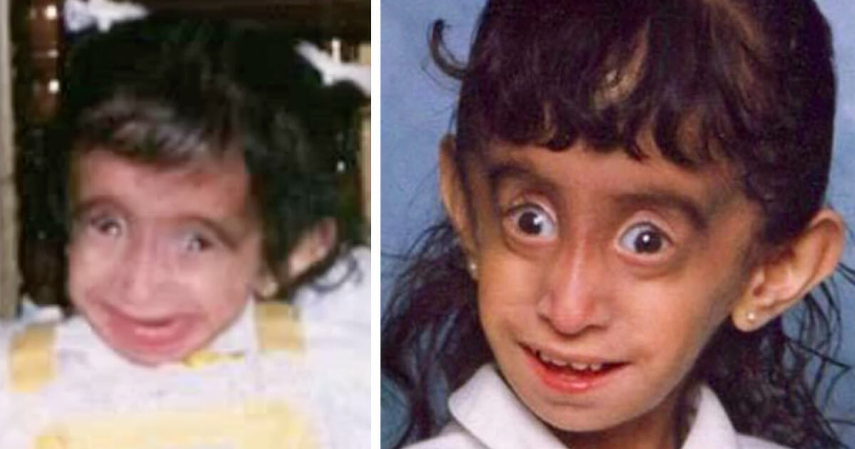 Die Hässlichste Frau Der Welt Bilder Lizzie Velasquez wurde als "hässlichste Frau der Welt" beleidigt