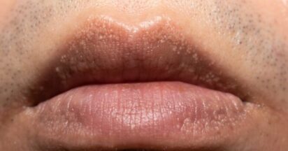 Puntini Madreperla Per Tastiera Chitarra - 6mm, Confezione 20 Pezzi, Bianco Naturale - Foto 5