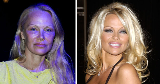 Pamela Anderson.