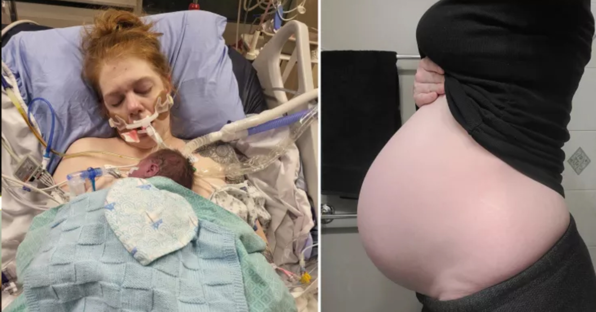 mamma attaccata a respiratore costretta a decidere destino del beb232