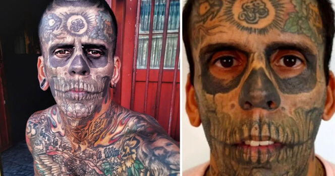 rimuove 170 tatuaggi dal corpo trasformazione sciocca tutti
