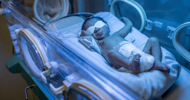 Nata senza cervello sfida la medicina e compie 20 anni