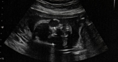 Un'influencer ha utilizzato contenuti generati dall'IA per un post "Baby Canceled", rivelando che il padre "non valeva niente". Credito: Shutterstock