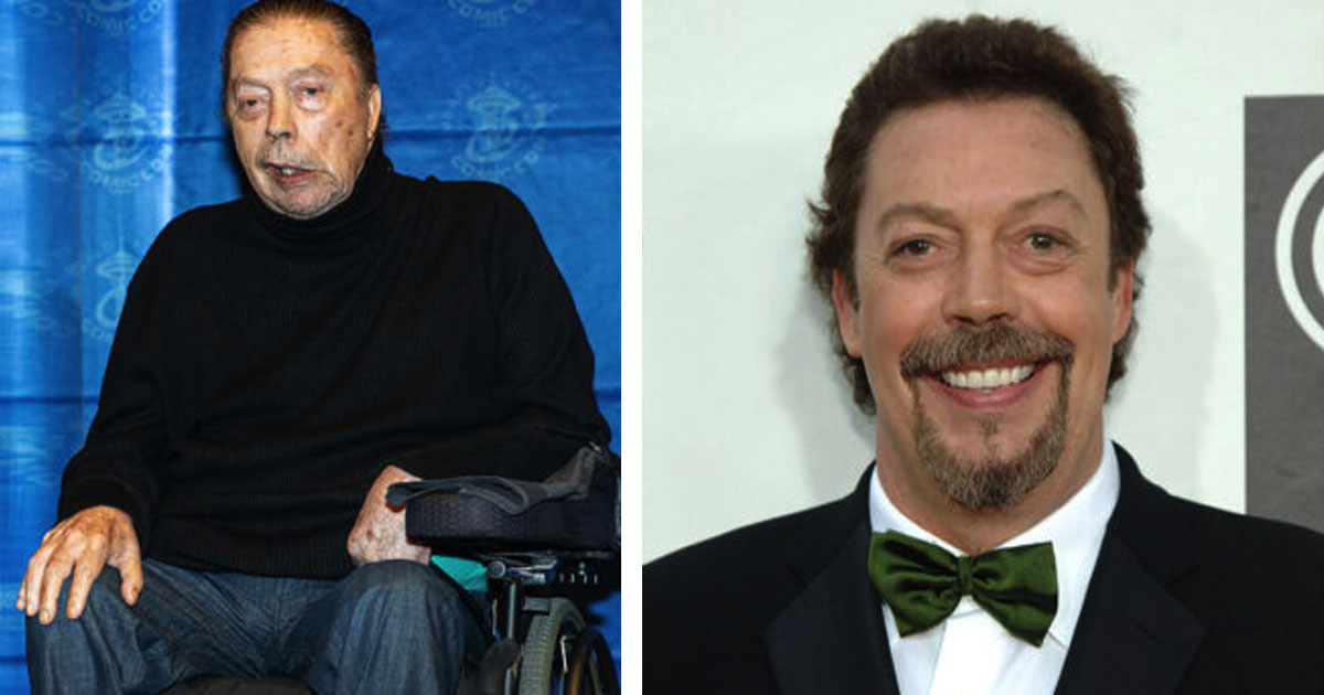 confermata causa di morte di tim curry malattia coronarica da Newsner.it confermata causa di morte di tim curry malattia coronarica