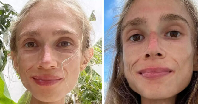vrouw fruitarisch dieet