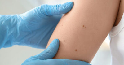 dokter arm