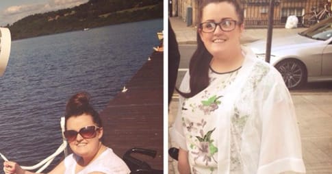 vrouw gezwollen voet