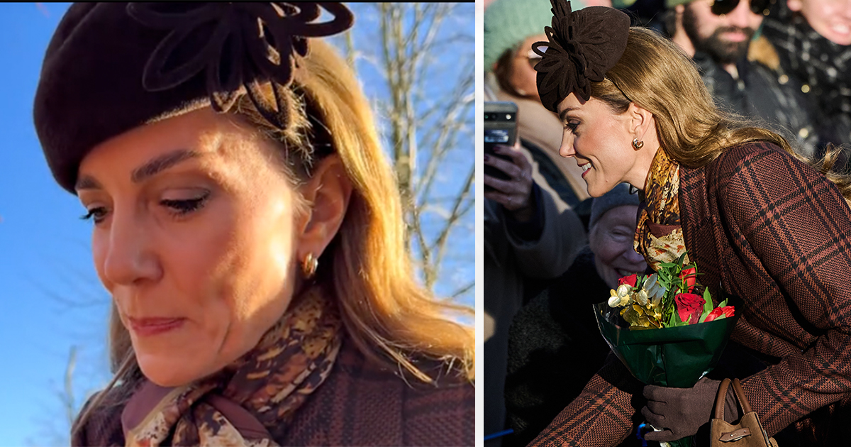 kate middleton litteken