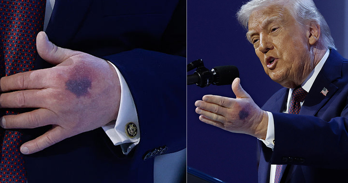 donald trump gezondheid