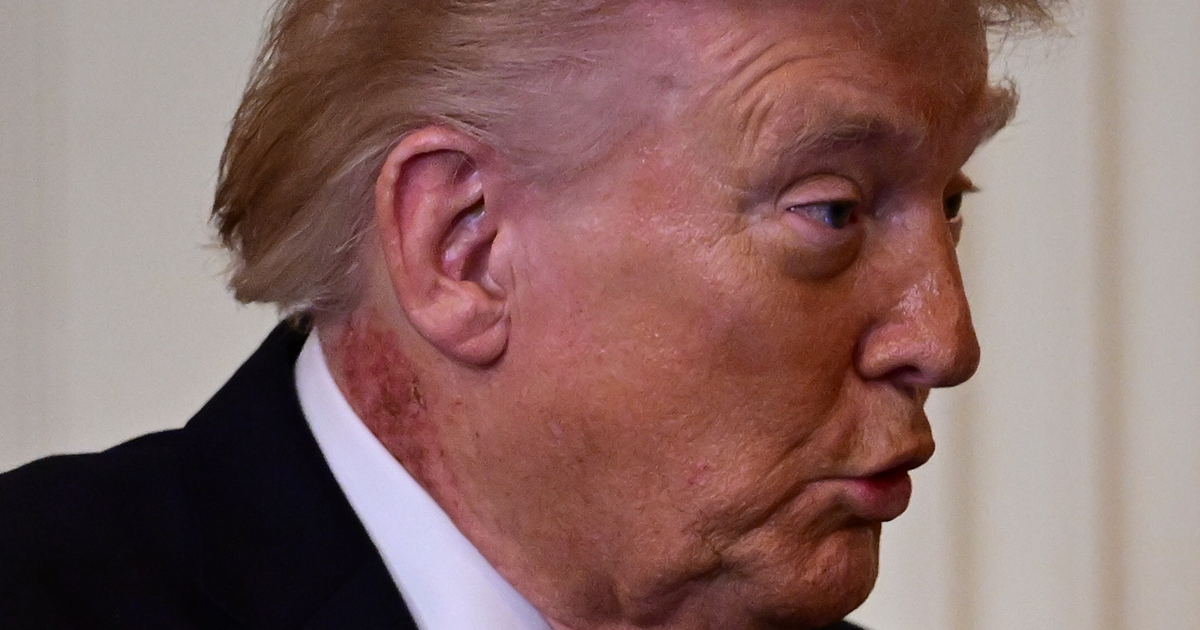 nekuitslag trump