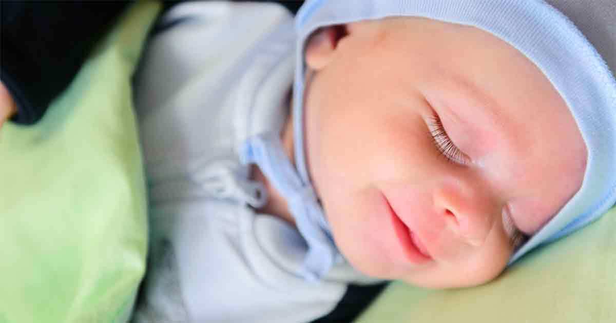 Harlequin baby 2
