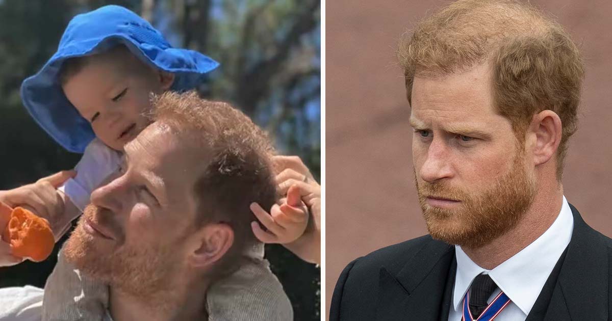 harry archie