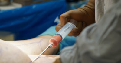 Injection